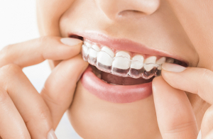 Férula de descarga + revisión dental