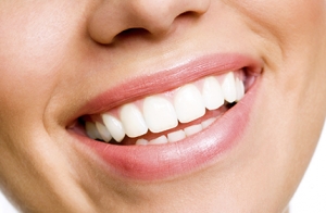 Blanqueamiento dental LED